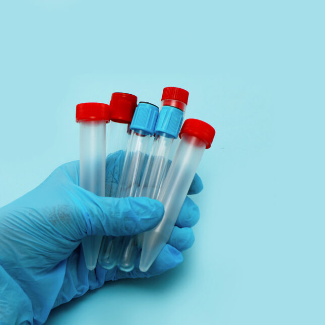 empty test tubes in the hand. -- first opinion coverage from STAT